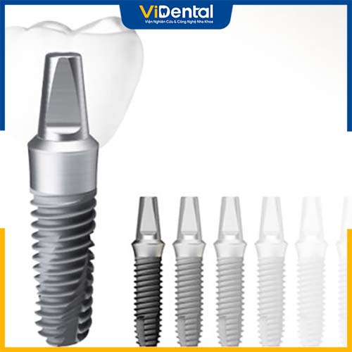 Việc lựa chọn loại trụ implant phù hợp sẽ giúp bạn hồi phục hình răng nhanh chóng