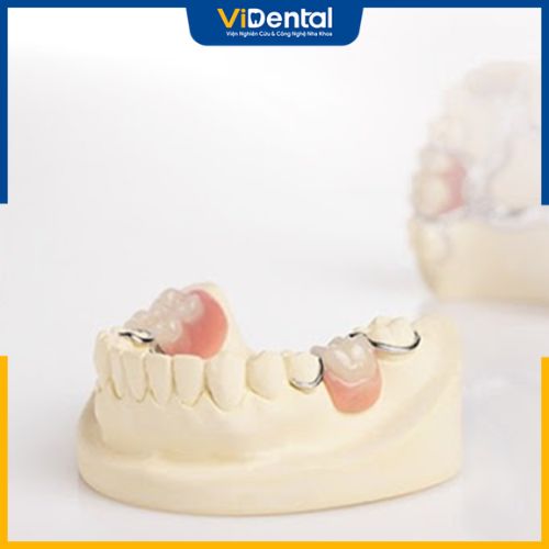 Hàm giả tháo lắp được áp dụng cho những trường hợp mất một, nhiều răng hoặc mất toàn hàm