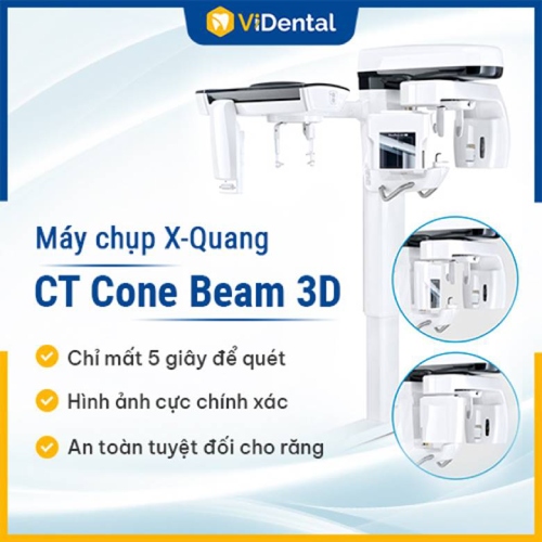 Vidental tiên phong đầu tư và ứng dụng công nghệ X-Quang CT Cone Beam 3D vào quá trình trồng răng