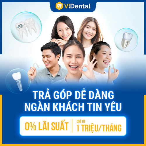 Trồng răng implant trả góp tại Vidental