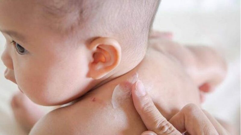 Trẻ bị viêm da cơ địa: nguyên nhân và cách điều trị tại nhà | Medlatec