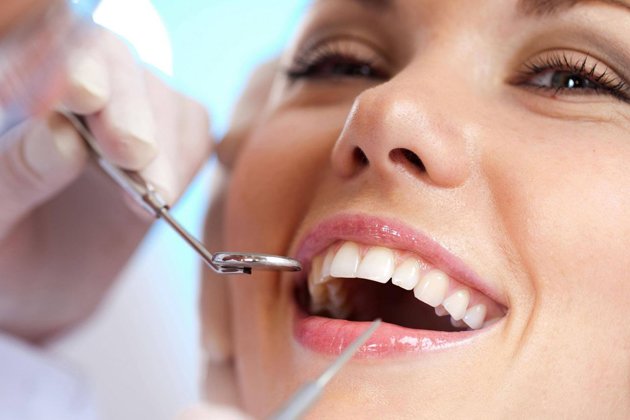 Hàn răng sâu miễn phí khám và tư vấn răng miệng tổng thể tại Nha khoa Sao  Việt