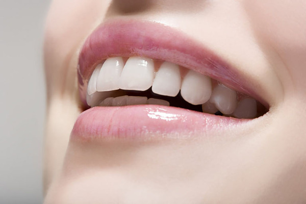 Bọc răng sứ 2 răng cửa bị hô giúp đem đến hàm răng đẹp