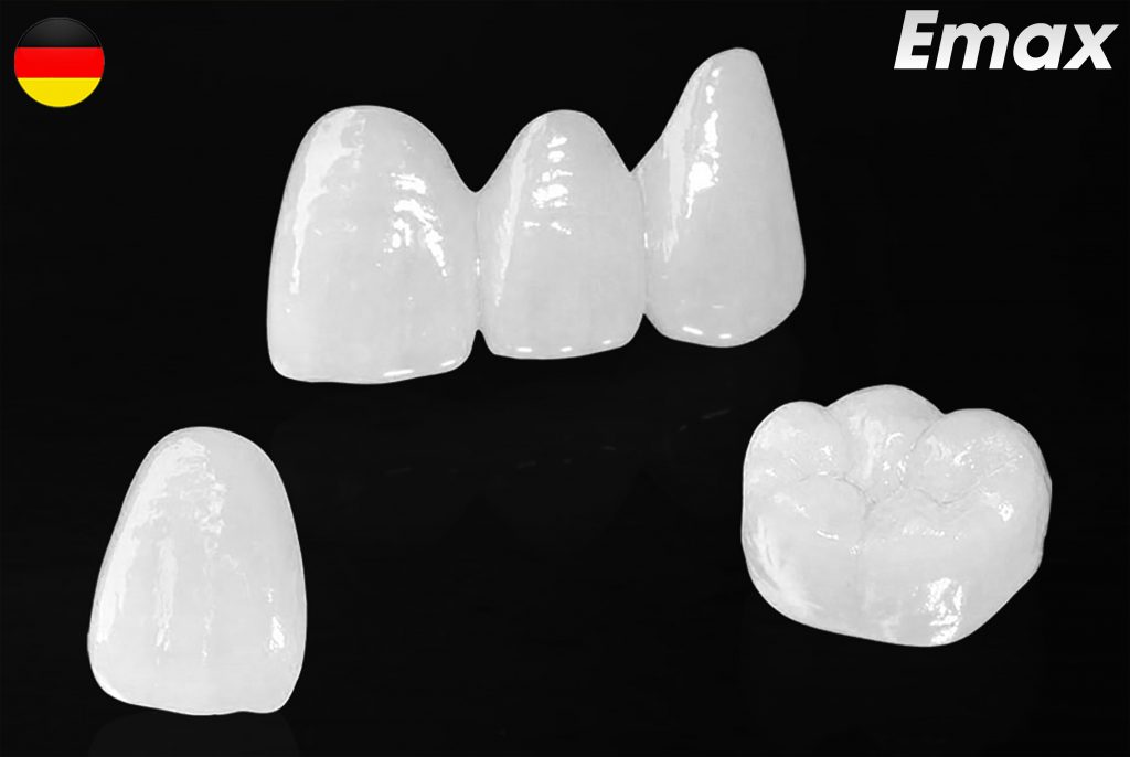 Các loại răng sứ cao cấp tại nha khoa Thùy Anh - nhakhoathuyanh