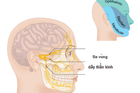  Khi dây thần kinh vận động ở mặt bị tổn thương sẽ gây ra tình trạng liệt dây thần kinh số 7 