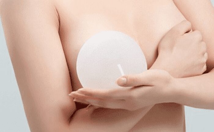 Rủi ro của phẫu thuật nâng ngực thường gặp
