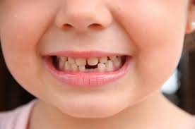 Độ tuổi bọc răng sứ phì hợp