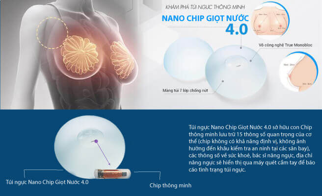 Nâng ngực sử dụng túi Nano Chip Giọt nước 4.0 hiện đại nhất 