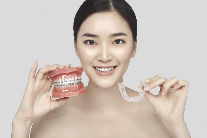 Phương pháp niềng răng không mắc cài 3D Clear áp dụng được cho nhiều đối tượng