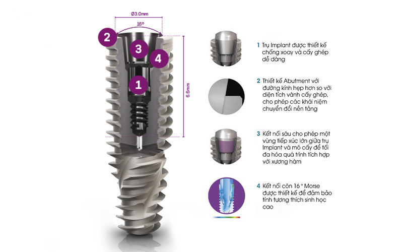 Trụ implant Neodent: Thông tin chi tiết về dòng trụ tốt nhất hiện nay