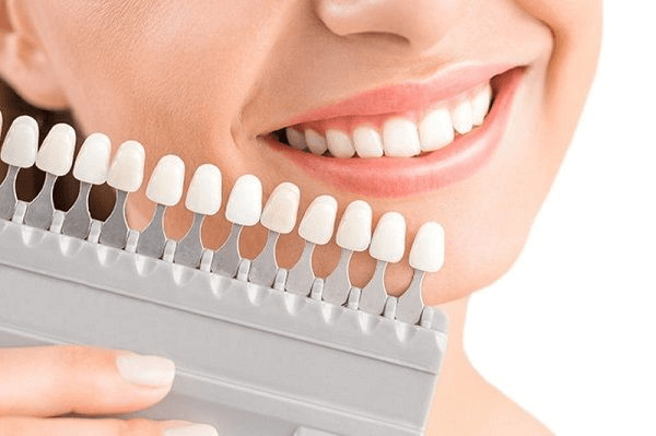 Bọc răng sứ giúp giải quyết nhiều vấn đề về răng miệng