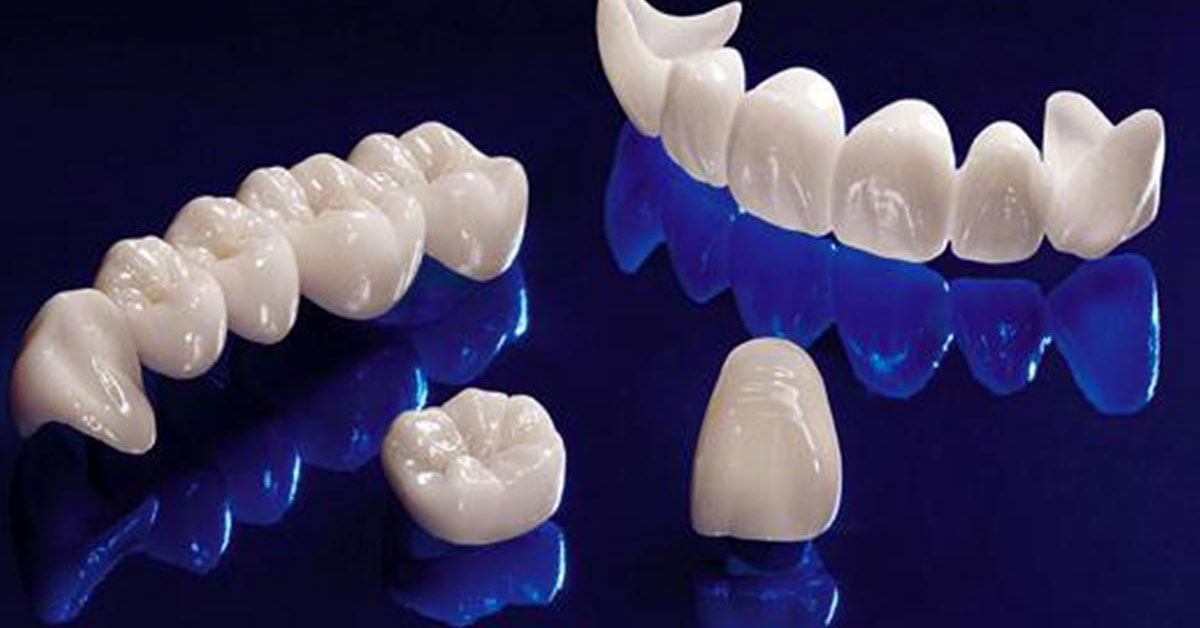 Công nghệ răng sứ cao cấp Hi-Zirconia cho răng đẹp tự nhiên