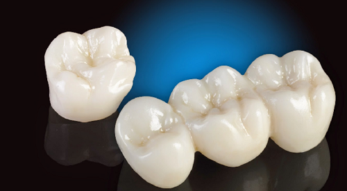 Làm răng sứ Cercon có bền không - Giá bọc răng sứ cercon