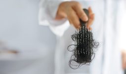 Rụng tóc là thiếu chất gì? Cách nhận biết