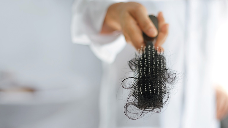 Rụng tóc là thiếu chất gì? Cách nhận biết