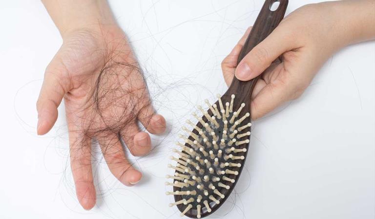 Rụng tóc gây ra nỗi ám ảnh cho nhiều người