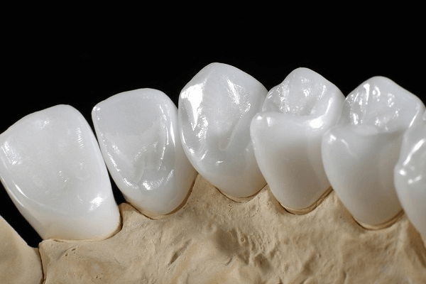 So sánh răng sứ zirconia và cercon: Những thông tin quan trọng cần biết